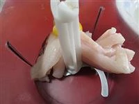 polpettine di sogliola immagine 1